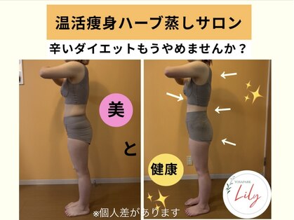 ヨサパーク リリー(YOSA PARK Lily)の写真