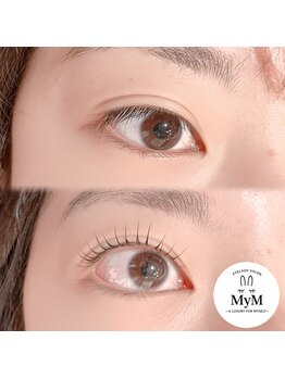 マイム(MyM)/施術例