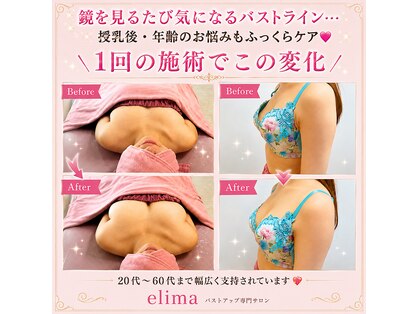 エリマ(elima)の写真