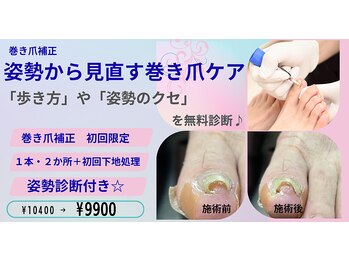 小田急相模原巻き爪センター 南口院の写真/巻き爪の痛みや見た目のお悩みに。歩き方・姿勢にも着目したケア。