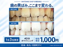 ホワイトニングショップ 京都四条店