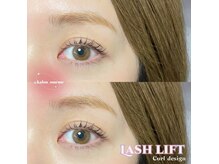 カロン(Kalon)/似合わせラッシュリフト