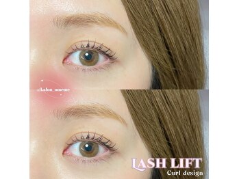 カロン(Kalon)/似合わせラッシュリフト