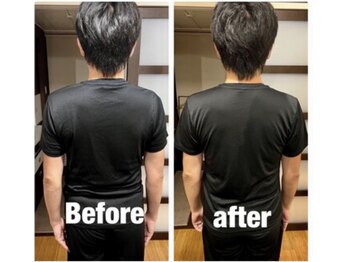 トトノウ 自由が丘店(totonou)/Before after (9)