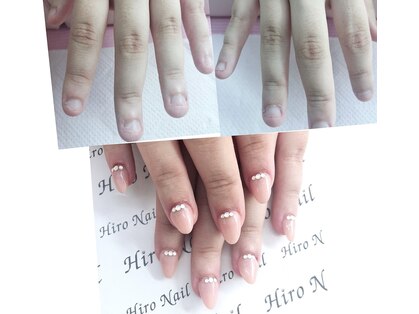 ヒロネイル(Hiro Nail)の写真