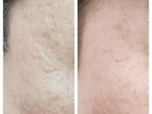 クリアー(CLEAR.)/【Before＆After】