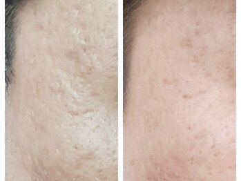 クリアー(CLEAR.)/【Before＆After】