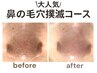《1カ月以内￥5900→￥4900》【即日効果実感◎】毛穴撲滅コース（鼻のみ）