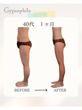 ジプソフィラ(Gypsophila)/痩身ビフォーアフター