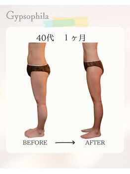 ジプソフィラ(Gypsophila)/痩身ビフォーアフター