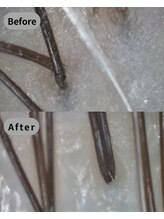 ストリクス(STRIX)/Before/After 【ヘッドスパ】