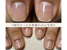 元深爪のお客様が美爪へ変化