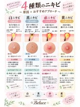ベルーチェ(Beluce)/4種ニキビケア