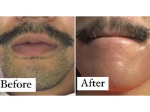 ダウニー(Downy)/30代/男性/お花屋さん