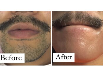 ダウニー(Downy)/30代/男性/お花屋さん