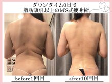 エムズボーテ(M's beaute)の雰囲気（理想の自分で世界で一番幸せな花嫁様に♪♪小顔＆二の腕プラン）