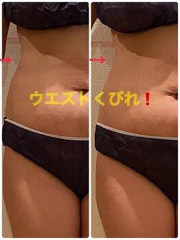 ヨサパーク エスポワール 三木店(YOSAPARK Espoir)/プレミアムコース