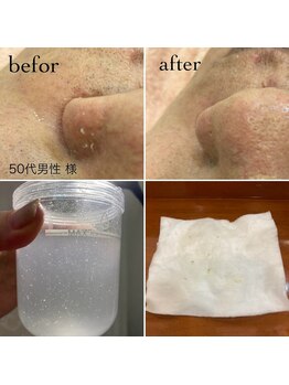 クレア 国際通りカーゴス店(CREA)/人気 ☆毛穴洗浄 ☆