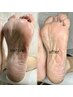 足裏角質ケア～甘皮ケアまで！すべすべフットケアコース♪