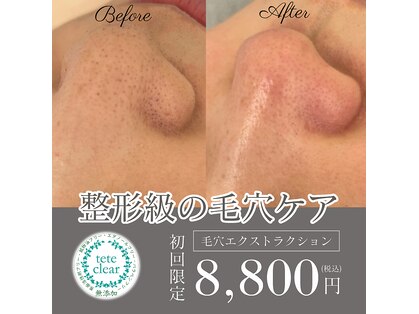ドラーダ(DORADA)の写真