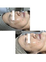 エルア 尼崎(Elua)/