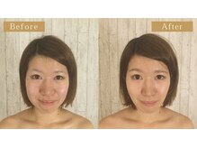 グレースフィオーレ 那覇店(gracefiore)/☆ビフォーアフター７☆