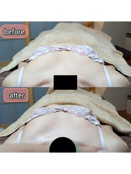 スノードロップ(snowdrop)/バストアップ　20代の方