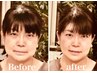 【左右さゆがみかみしめ改善小顔矯正】脳洗浄/エンドリングフェイシャル12000