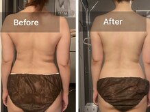 アンジュリーク(Ange'ique)/撮影　before after、、