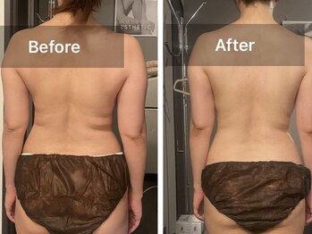 アンジュリーク(Ange'ique)/撮影　before after、、