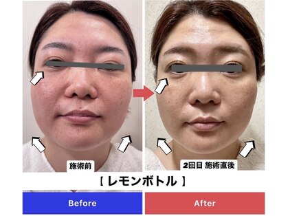 エトワール(etoile)の写真