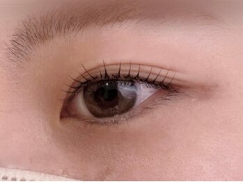 リタイムビューティー(Re:Time Beauty)/施術イメージ