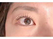 マイム(MyM)/施術例