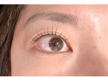 マイム(MyM)/施術例