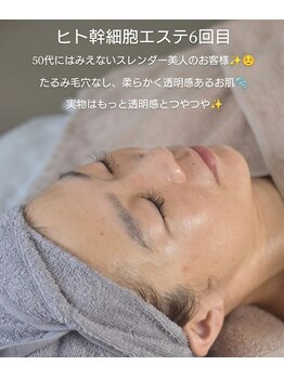 ココルーネ(COCORUNE)/ヒト幹細胞スペシャルコース