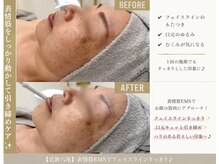 マグノリア(Magnolia)の雰囲気(【たるみ改善】表情筋の引き締めにEMS。たるみ改善に◎)