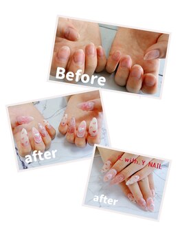 アール ウィズ ワイネイル(R.with.Y NAIL)の写真/爪の悩みに寄り添う施術◎ひとりひとりの状態に合わせた丁寧なケアで、健やかで美しい自爪へ♪