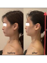 エミナル(EMINALu)/小顔矯正は首ケアが必須