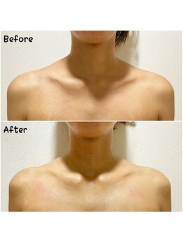 ファミーユ(famille)/辛い肩こりお任せください!