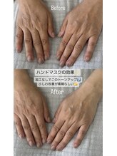 シーオングル(Siii ongle)/フットをしながらハンドマスク