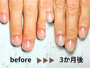 深爪自爪育成3か月の変化