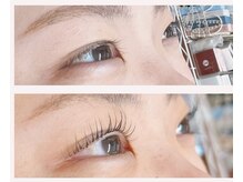 【ダブルアイリフト】