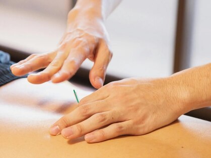 藤江鍼灸の写真