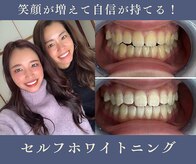 グリッター ショウナン(glitter. SHONAN)