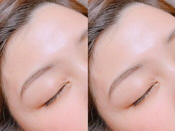 エールバイショールーム(YELL by showroom)の写真/美肌効果もあるお顔のWAX脱毛や、最先端マシンケアでツルツル美肌へ♪毛穴が引き締まりお化粧ノリもUP☆