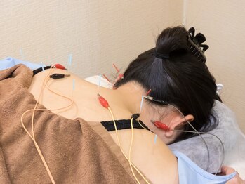 いなほ はりきゅう整骨院 東新宿/鍼灸(吸い玉併用)コース