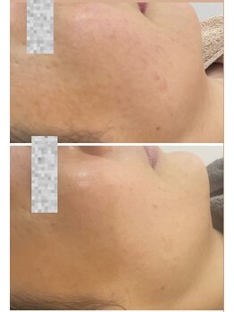 エステサロンパリス(Esthe Salon Paris)/くすみ・ごわつきサヨナラ!