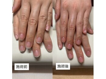 パラスパガーデン センダイ アングゥ(para spa GARDEN sendai ungu)/◇パラコーティングで自爪育成