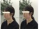エール シガ(AILE SHIGA)の写真/【たるみ顔卒業!】鏡を見るたび気になるたるみ・・今こそ本気の引き締まった小顔矯正◆初回2,980/南草津