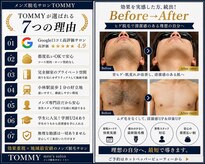 トミー(TOMMY)